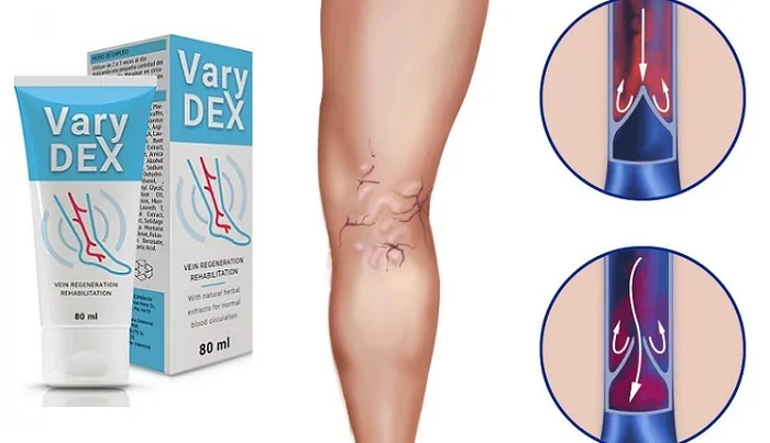Varix cream : Azərbaycanda hardan, aptekdən ala bilərəm?